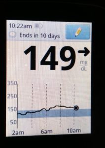 CGM 8 hours after 10 grams true-liposomal vitamin C